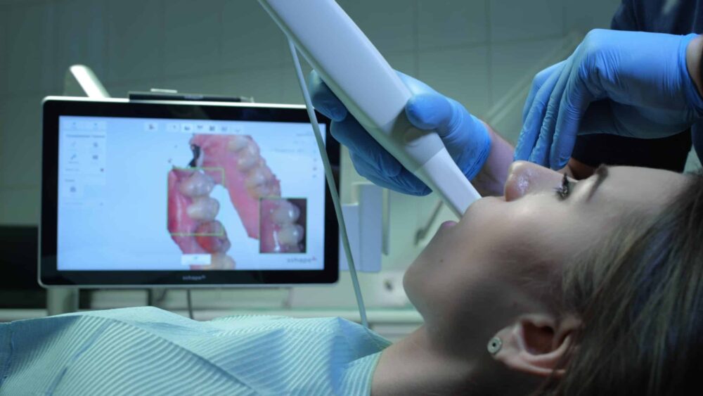 Digital dental scans Burnet